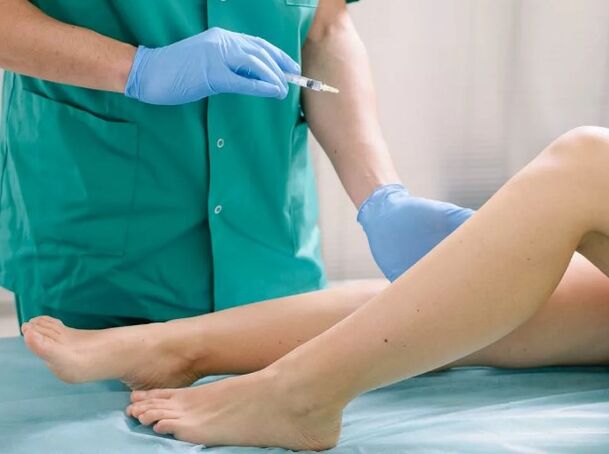 Tratamento de varices